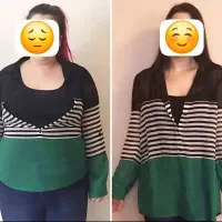 ۴۰٪ آف لاغری پیکرتراشی ساکشن غبغب بلفا پزشک زیبایی