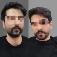 زیبا سازی|خدمات آرایشگری و زیبایی|سقز, |دیوار