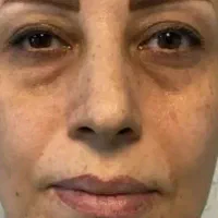 ضدلک اصل فرانسوی|حراج|قم, زنبیل آباد|دیوار