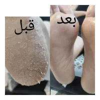 آف ویژه کاشت ناخن وپدیکورکف سابی