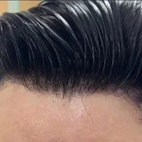 تخصصی ترین کلینیک پروتز مو در تهران (نقد و اقساط)|خدمات آرایشگری و زیبایی|تهران, صادقیه|دیوار