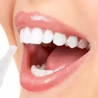 قلم سفید کننده دندان /لمینت/زیبایی/کامپوزیت|خدمات آرایشگری و زیبایی|اردبیل, |دیوار