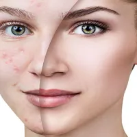 فیشیال در کلینیک پادرا