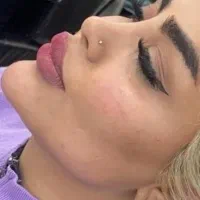 پزشک جراحی بلفا غبغب نخ لیفت کلاژن آنزیم ژل فیلر|خدمات آرایشگری و زیبایی|کرج, گوهردشت|دیوار