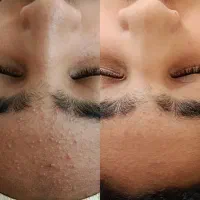 فیشال و پاکسازی و خدمات پوست