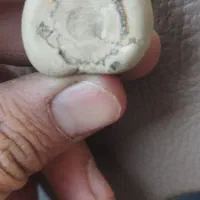 سنگ فسیل|کلکسیون اشیاء عتیقه|کرج, حسن آباد|دیوار