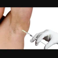 جشنواره بوتاکس زیربغل جلوگیری از تعریق|خدمات آرایشگری و زیبایی|سبزوار, کاشفی شمالی (دادگستری)|دیوار