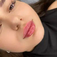 تخفیف لب روسی درمان لک و جوش مزو