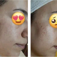 درمان مشکلات پوستی تخصصی|آرایشی، بهداشتی، درمانی|ارومیه, |دیوار