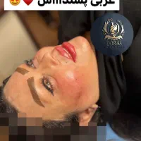 تزریق تخصصی ژل ومادلینگ خلیجی واروپایی وبوتاکس|خدمات آرایشگری و زیبایی|کرمانشاه, |دیوار