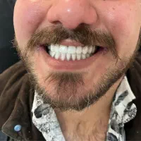 دندان مصنوعی + دندانسازی