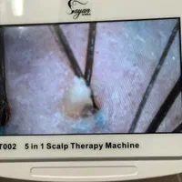 درمان قطعی شوره ،چربی،و انواع ریزش های مو|خدمات آرایشگری و زیبایی|اصفهان, چشمه باقرخان|دیوار