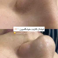 فیشال تخصصی پوست