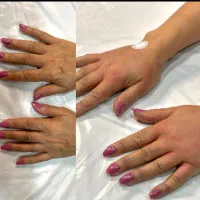 ژل و بوتاکس و مزو ژل|خدمات آرایشگری و زیبایی|بومهن, |دیوار