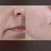 تزریقات تخصصی ژل و بوتاکس