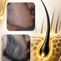 محصول افزایش مو