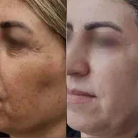 پک روشن کننده پوست صورت و بدن