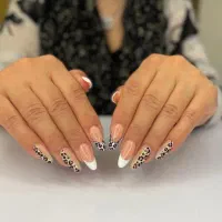 کاشت ناخن پرند