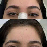 مدل اصلاح ابرو