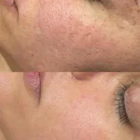 فیشال|خدمات آرایشگری و زیبایی|شیراز, شهرک سراج‎|دیوار