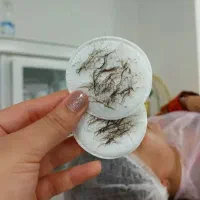 درماپلنینگ و اصلاح