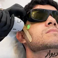 لیزر موهای زائد تخصصی آقایان پی آر پی مزو|خدمات آرایشگری و زیبایی|مشهد, کوه سنگی|دیوار