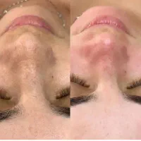 فیشیال تخصصی