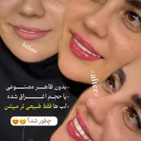 جشنواره تخفیفات تابستانه کلینیک رویال