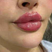 **ژل و بوتاکس و آموزش**