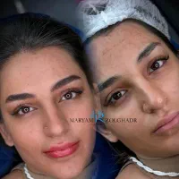 فیبورز ابرو / میکروبلیدینگ /شیدلب / ین مژه