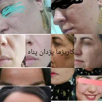 پک سفیدکننده ضدلک فوق حرفه ای کاریزماتیک|آرایشی، بهداشتی، درمانی|شیراز, سیاه سنگ|دیوار