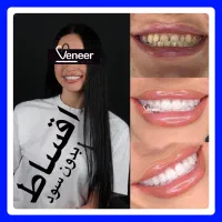 دندانپزشکی لمینت لیفت لثه کامپوزیت نانو اقساط