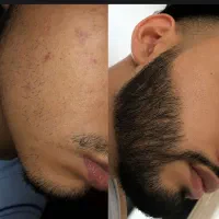 بترکون با محصولی که همه دنبالشن