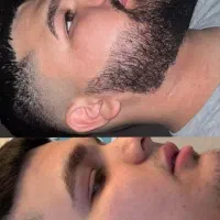 راز داشتن ریش پرپشت