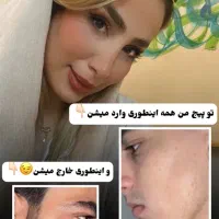 درمان کمپشتی ورویش ریش سبیل