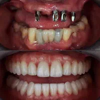 دندانپزشکی  تخصصی ترین مرکز ایمپلنت و جراحی|خدمات آرایشگری و زیبایی|ورزقان, |دیوار