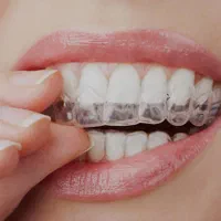 ارتودنسی|خدمات آرایشگری و زیبایی|اصفهان, خواجو|دیوار
