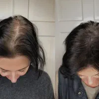 پروتزکف سری وچتری الیاف اروپایی بسیارطبیعی باکیفیت