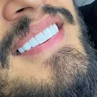 آموزش دندانپزشکی خصوصی در تمام موارد