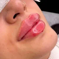 ژل لب/ساکشن غبغب/لیفت/چشم گربه ای/کانتورینگ