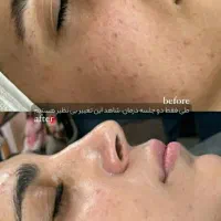 مدل کاشت ناخن و فشیال و اصلاح|خدمات آرایشگری و زیبایی|پرند, فاز ۴|دیوار