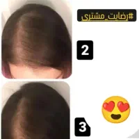 پک ریزش و رویش مجدد مو|آرایشی، بهداشتی، درمانی|تهران, فلاح|دیوار