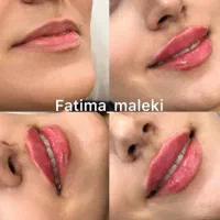 آفر ویژه آموزش حرفه ای فیلر و بوتاکس تا آخر هفته|خدمات آموزشی|تهران, هفت حوض|دیوار