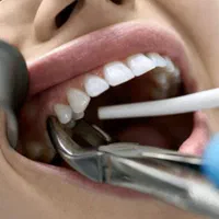 استخدام دستیار کنار دندانپزشک