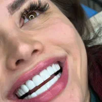 دندان پزشکی / کامپوزیت / ایمپلنت / اقساط|خدمات زیبایی و سلامت|تهران, نیروی هوایی (پیروزی)|دیوار