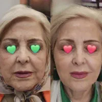 بیوممتیک(معجزه پوست)از نمایندگی اصلی