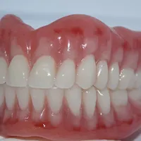 لابراتوار دندانسازی (پروتزهای دندانی .دندان مصنوعی|خدمات آرایشگری و زیبایی|تهران, کیانشهر|دیوار