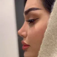 تخفیف عمل بینی لیپو ابدو لیفت ابرو وکاشت ابرو و مو|خدمات آرایشگری و زیبایی|اسلامشهر, شهرک لاله|دیوار