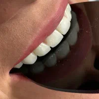 دندانپزشکی با تعرفه یکسال قبل و کیفیت بالا|خدمات زیبایی و سلامت|شیراز, نشاط|دیوار