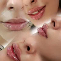 تزریق ژل فیلر بوتاکس مزوژل جوانساز مزوتراپی